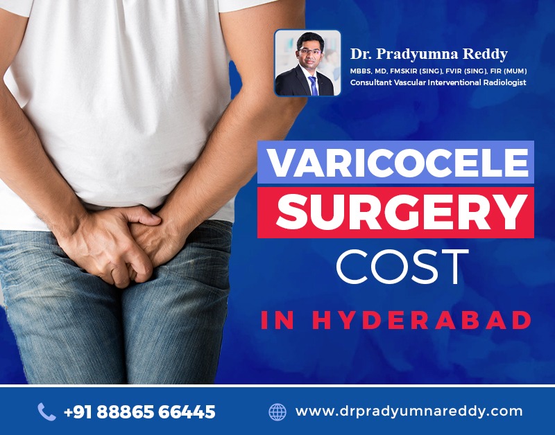 Varicocele Treatment Cost in Hyderabad
