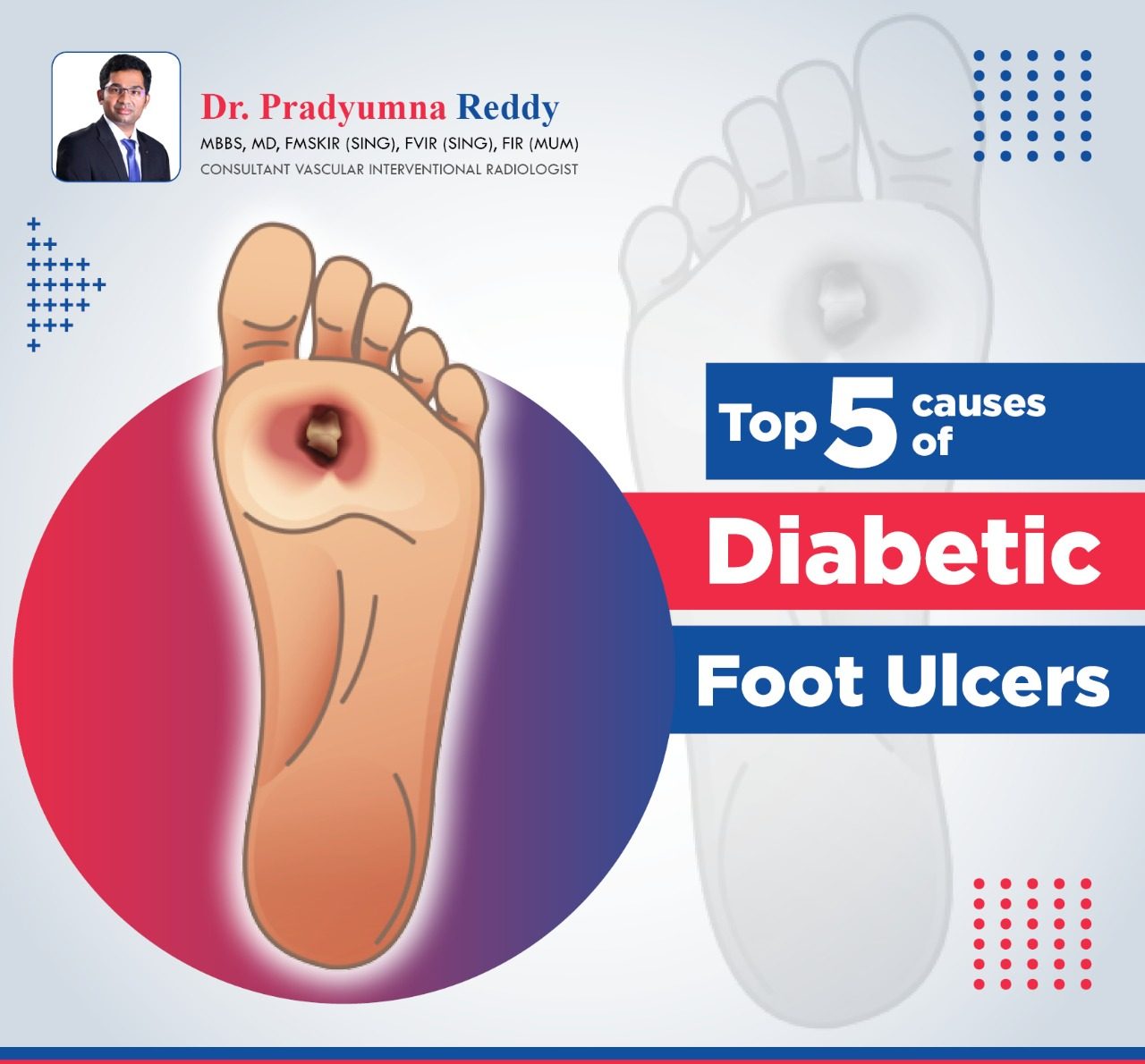 Hyperglycemic crisis and diabetic foot ulcers