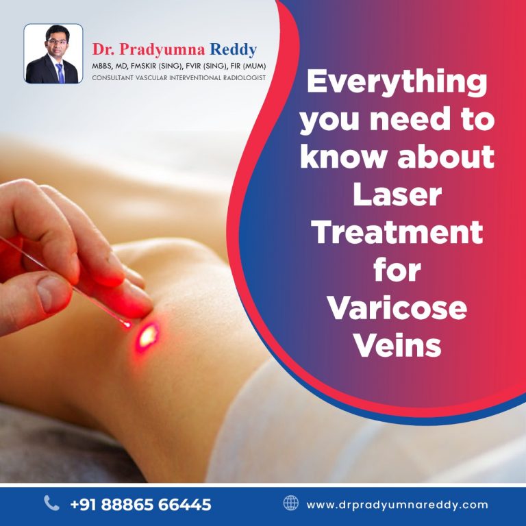 Laser Treatment For Varicose Veins In Hyderabad