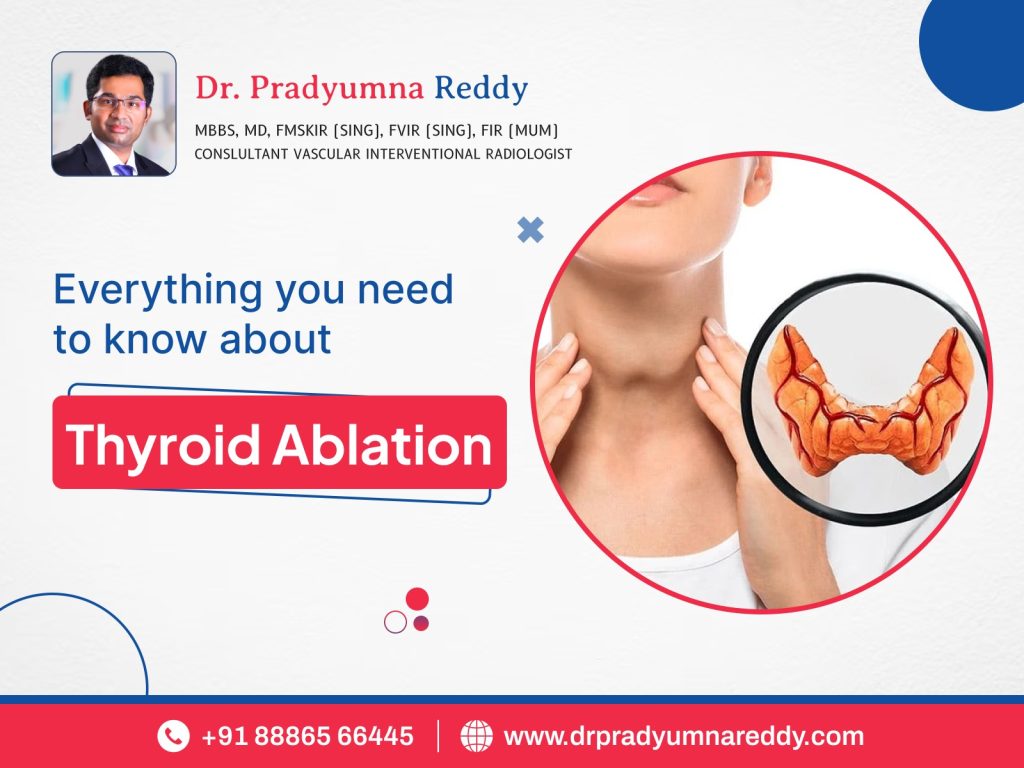 Everything You Need To Know About Thyroid Ablation