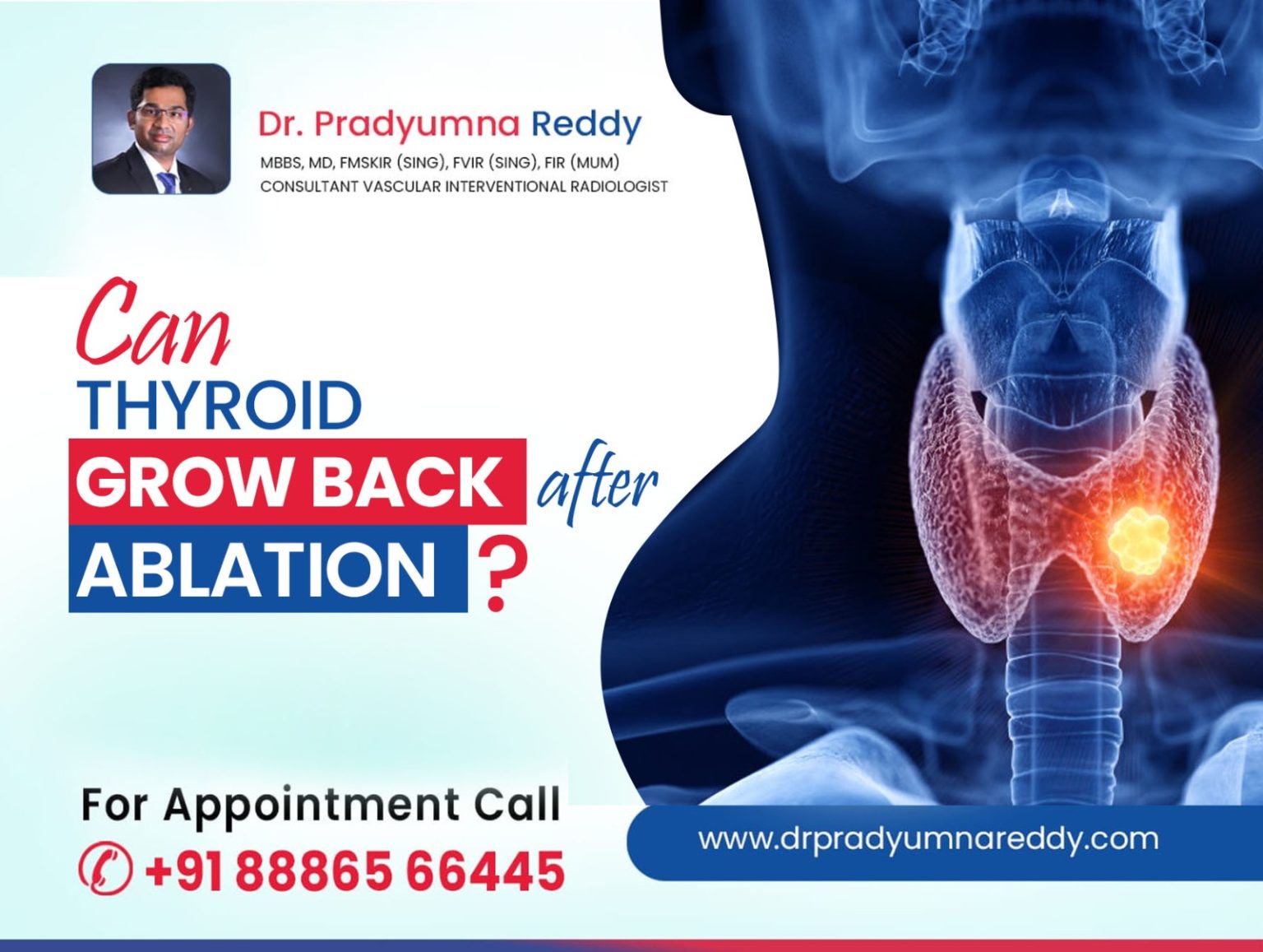 can-thyroid-grow-back-after-ablation