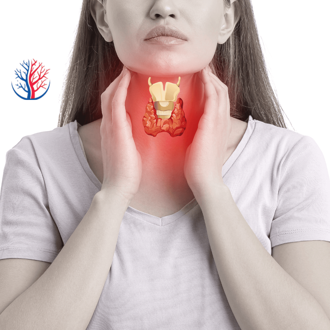 Thyroid Nodule explained by Doctor Pradyumna Reddy